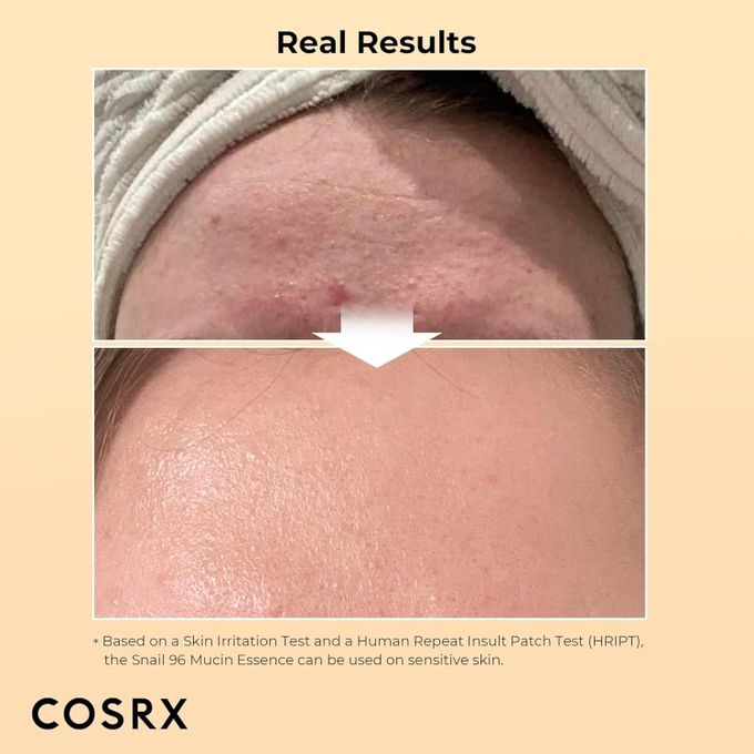 Cosrx Advanced Snail 96 Mucin Power Essence, 100ml