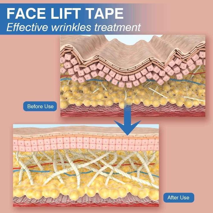 Wrinkle Tape Roll Face Lift Tape Breathable Cotton Elastic Anti-Wrinkle V-Line Lifting - 5m * 5cm
