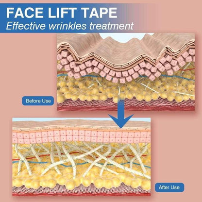 Wrinkle Tape Roll Face Lift Tape Breathable Cotton Elastic Anti-Wrinkle V-Line Lifting - 5m * 5cm