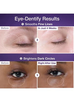 No.9 NAD+ Retinol Volumetox Eye Cream 10ml