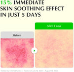 GREEN AID ALOE PDRN CALMING Serum 30ml