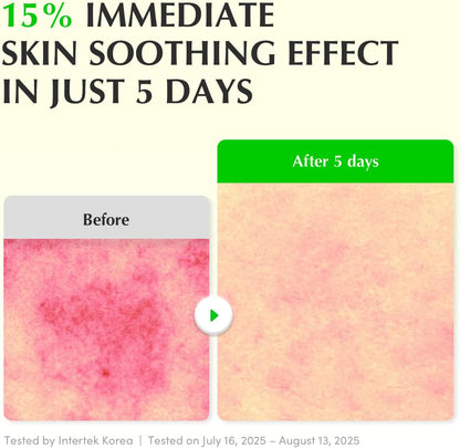 GREEN AID ALOE PDRN CALMING Serum 30ml