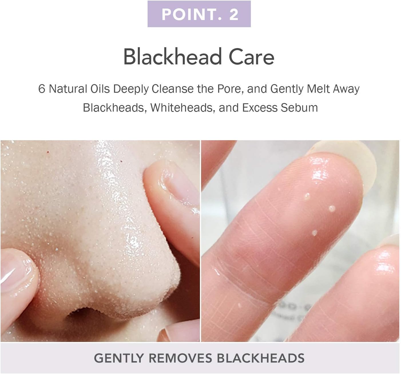 derma nature fresh blackhead jojoba cleansing oil 150ml
