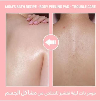 Mom’s Bath Recipe Body Peeling Pad Pack 8pcs – Foam Exfoliation for Smooth Skin