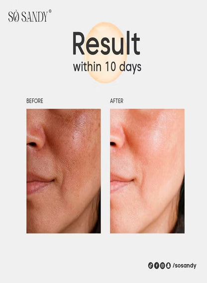 SHINE AND WHITE FACE SERUM Tranexamic Acid - Bee Venom With Whitening Effect 30ml