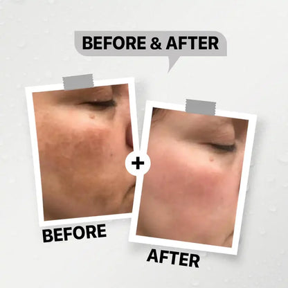 Day Whitening Cream For dark areas -  60g