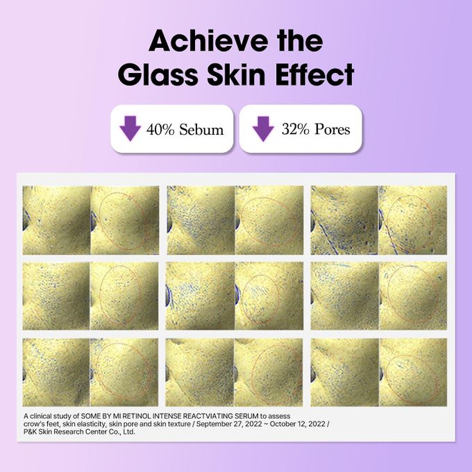 Some By Mi Retinol Intense Reactivating Serum – Gentle Beginner Retinol with Bakuchiol - 30ml