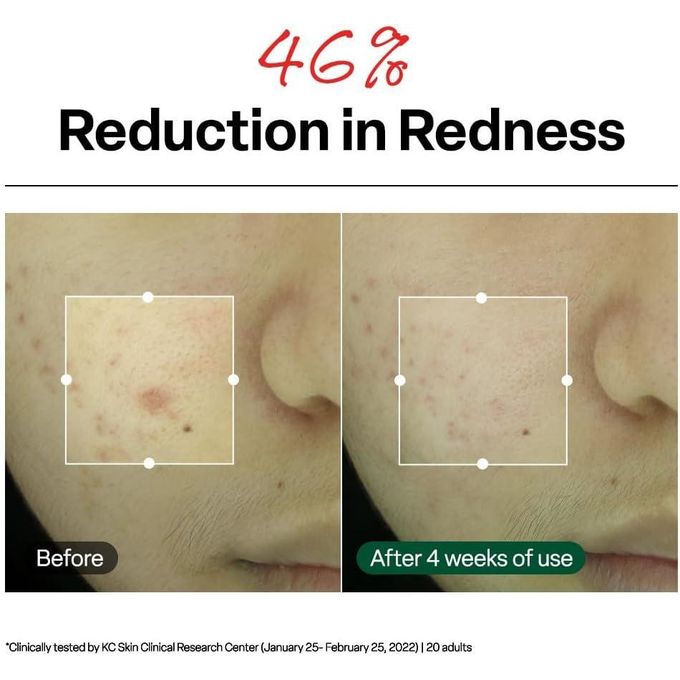 Dr.G R.E.D BLEMISH Clear Soothing Cream – Lightweight Moisturizer for Sensitive & Irritated Skin - 70ml
