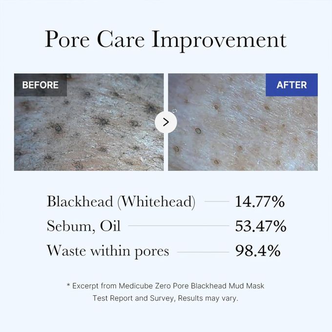 Medicube Zero Pore Blackhead Mud Facial Mask - Skin Cooling & Pore Tightening - 3 Minute Quick Dry Formula With AHA, BHA, PHA, And Pore-Purifying Clay - Korean Mud Mask 100g