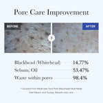 Medicube Zero Pore Blackhead Mud Facial Mask - Skin Cooling & Pore Tightening - 3 Minute Quick Dry Formula With AHA, BHA, PHA, And Pore-Purifying Clay - Korean Mud Mask 100g