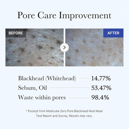 Medicube Zero Pore Blackhead Mud Facial Mask - Skin Cooling & Pore Tightening - 3 Minute Quick Dry Formula With AHA, BHA, PHA, And Pore-Purifying Clay - Korean Mud Mask 100g