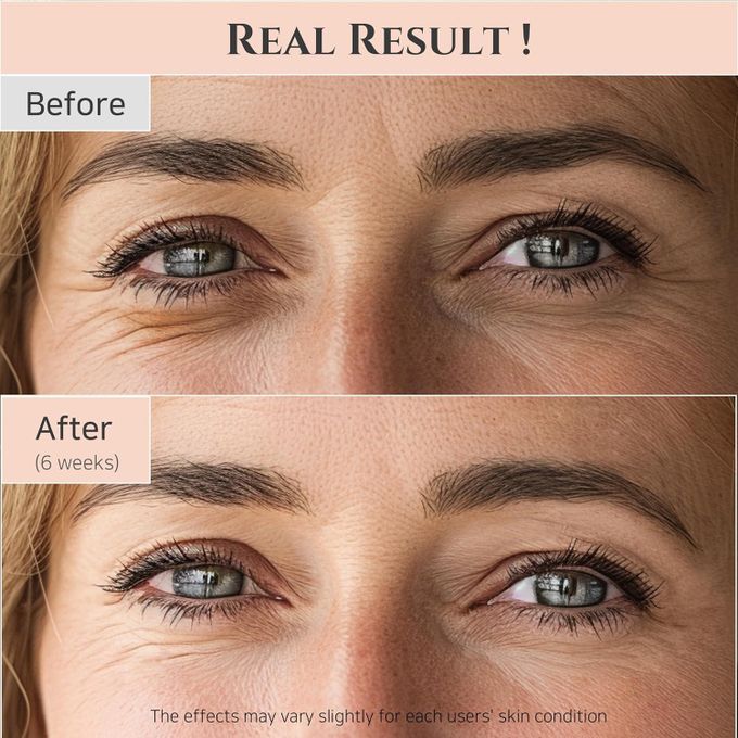 Beauty of Joseon Revive Eye Serum with Retinal Niacinamide - 30ml