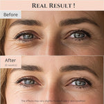 Beauty of Joseon Revive Eye Serum with Retinal Niacinamide - 30ml