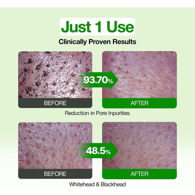 Fully Green Tomato Clay Mask Cleanser – 2-in-1 Vegan Pore Care Face Mask & Cleanser - 120ml