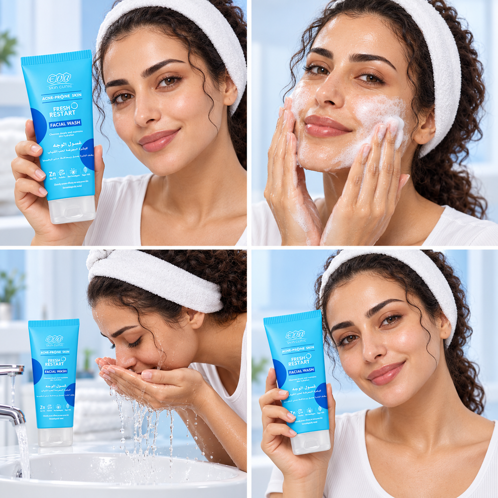 Skin Clinic Fresh Restart Facial Wash for Acne-Prone Skin – 150 ml