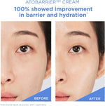 Atobarrier 365 Cream face Moisturizer for Dry Sensitive Skin - 10ml